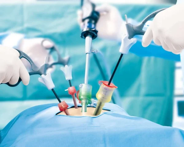 Laparoscopy Surgery in Thane